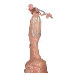 CATALISADOR FOCUS 2.0 2009 2010 A 2013